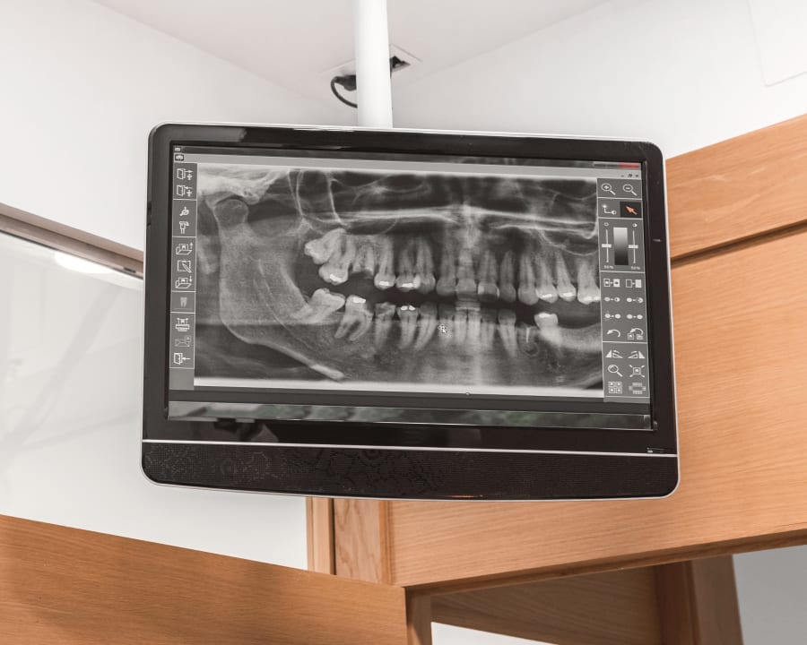 La radiographie numérique - Centre de santé dentaire Al Dente à St-Jérôme